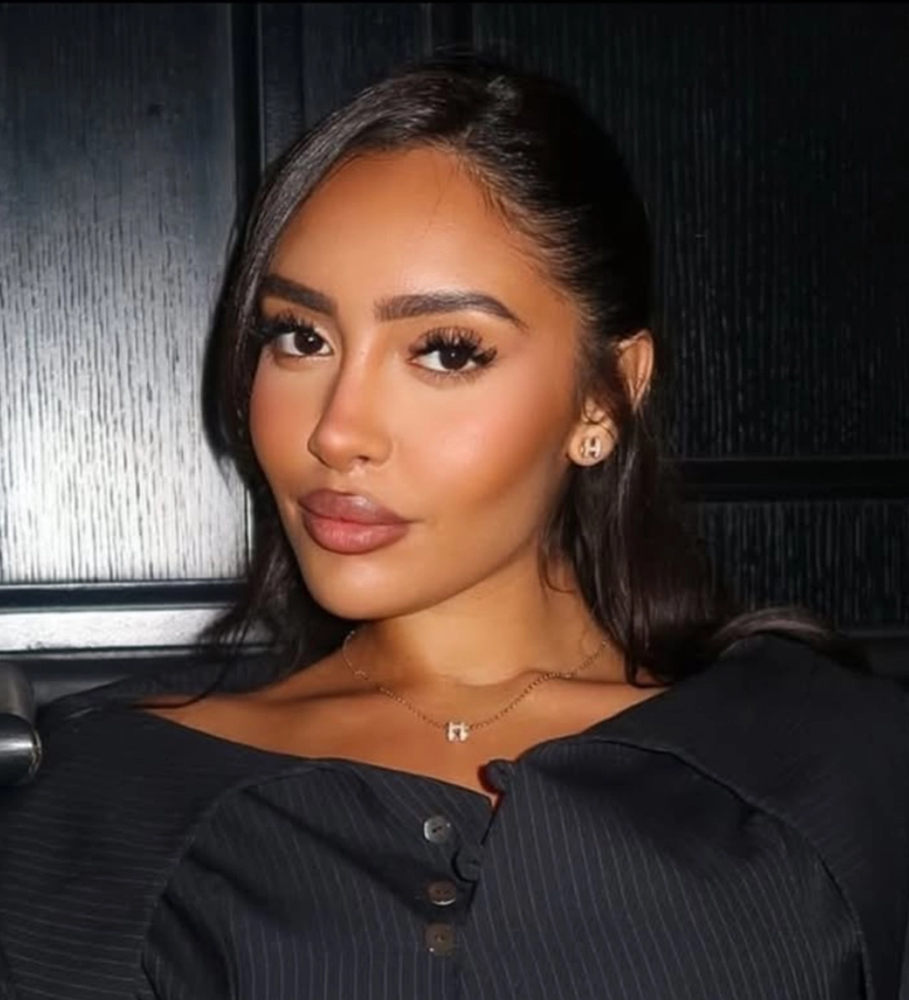 Revision rhinoplasty — Op. Dr. Arda Pelen