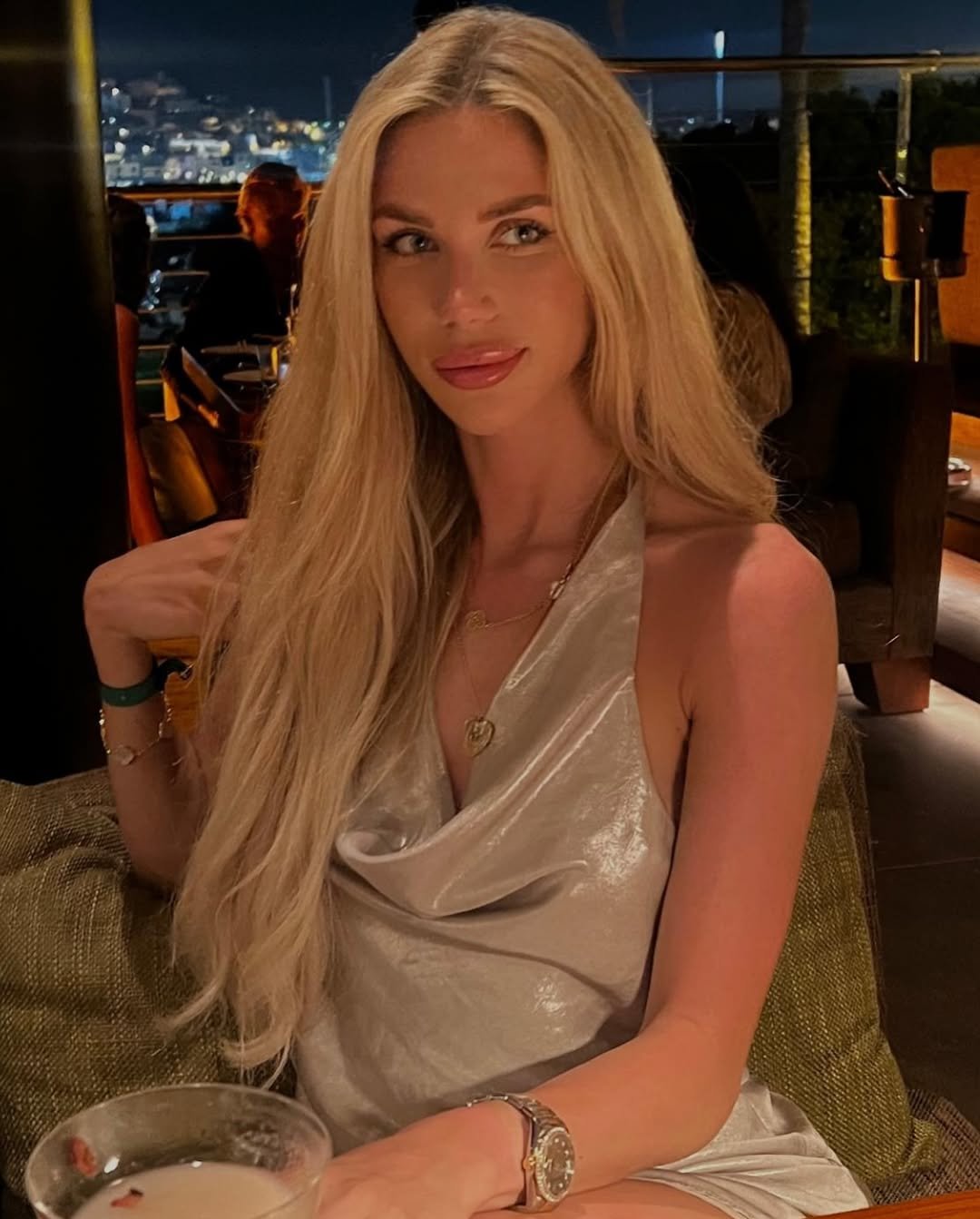 Long-term tipplasty result