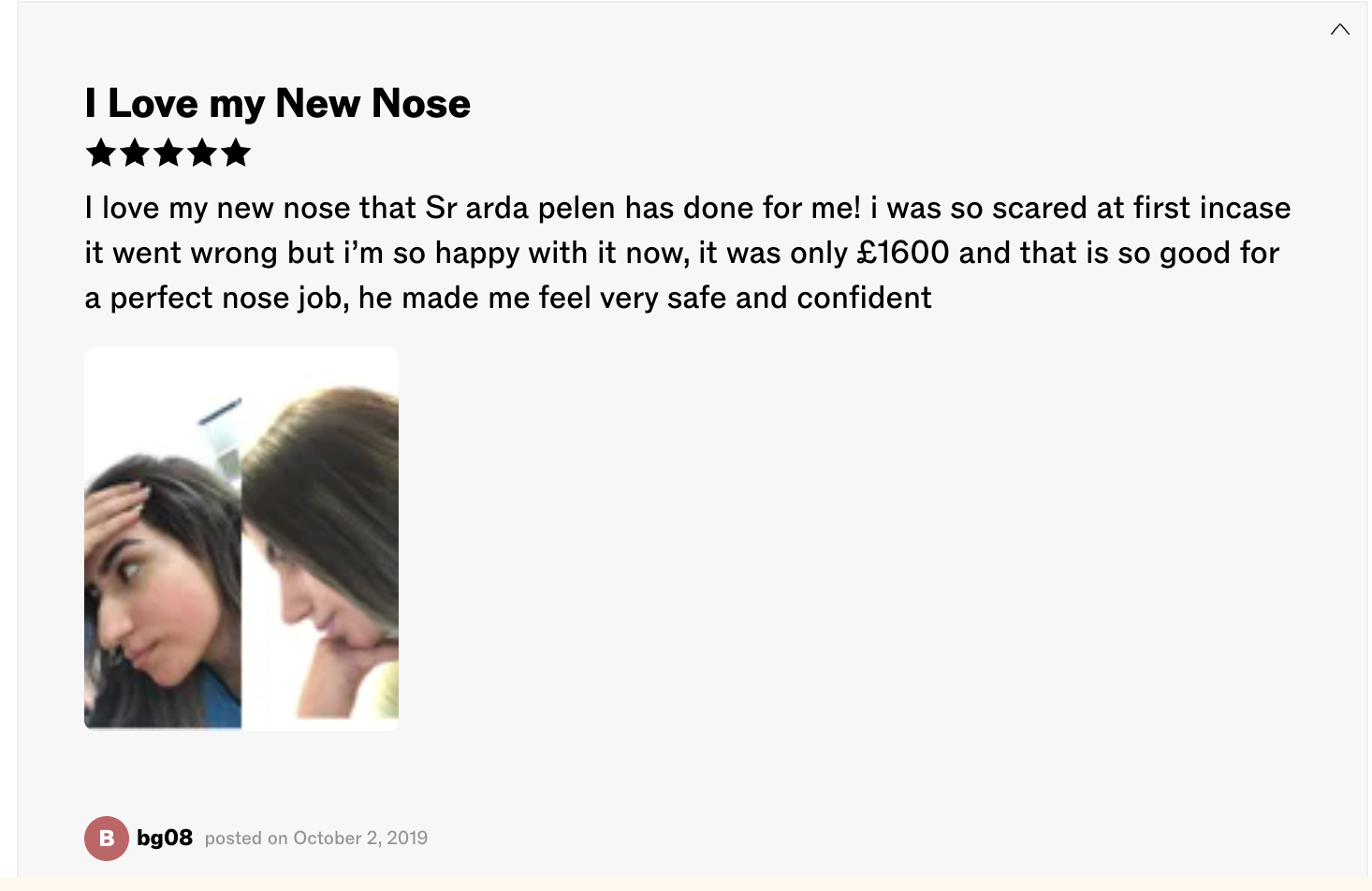 Verified patient review — Op. Dr. Arda Pelen